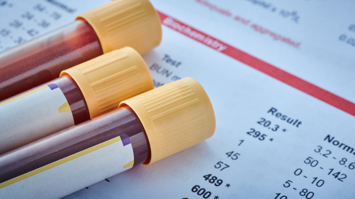 des tubes de sang servant aux analyses médicales