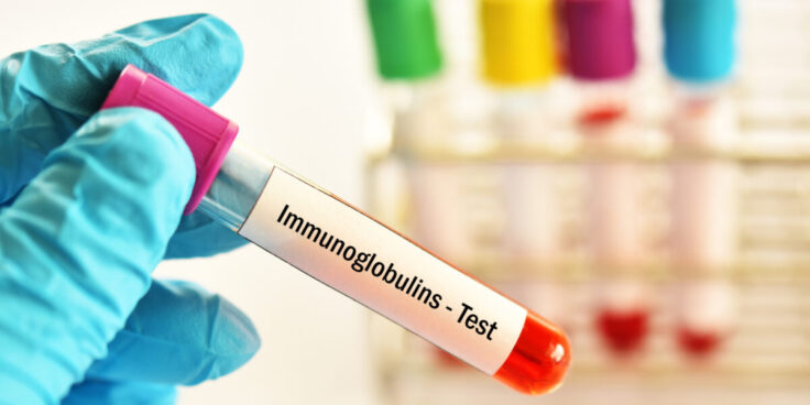 Maladies auto-immunes : accompagnement et détection, comment renforcer son immunité ?